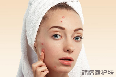 額頭冒痘的日常護(hù)理