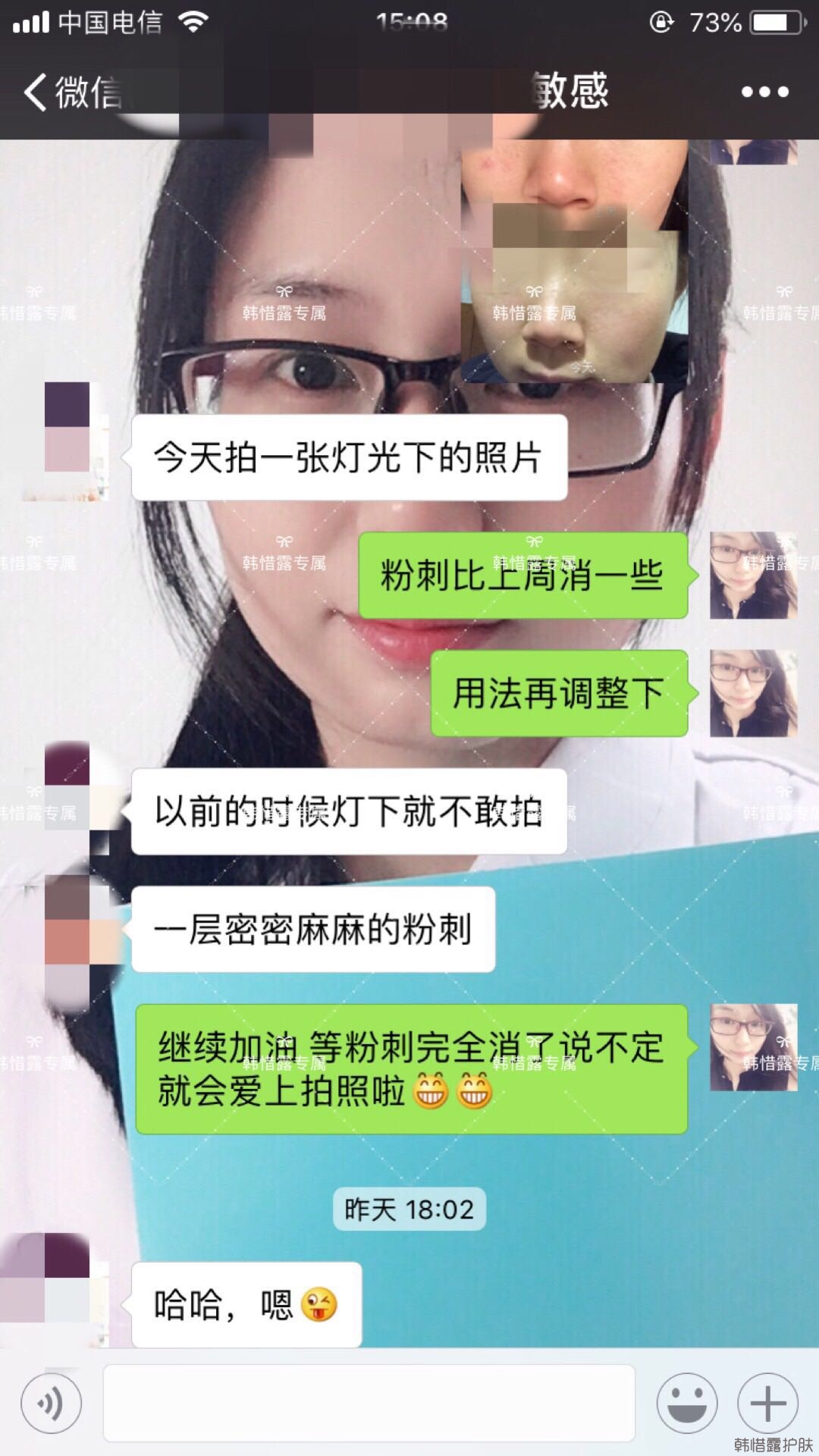 粉刺痘痘怎么有效去除？以前不敢拍燈光下照片，粉刺少了，現(xiàn)在敢了！