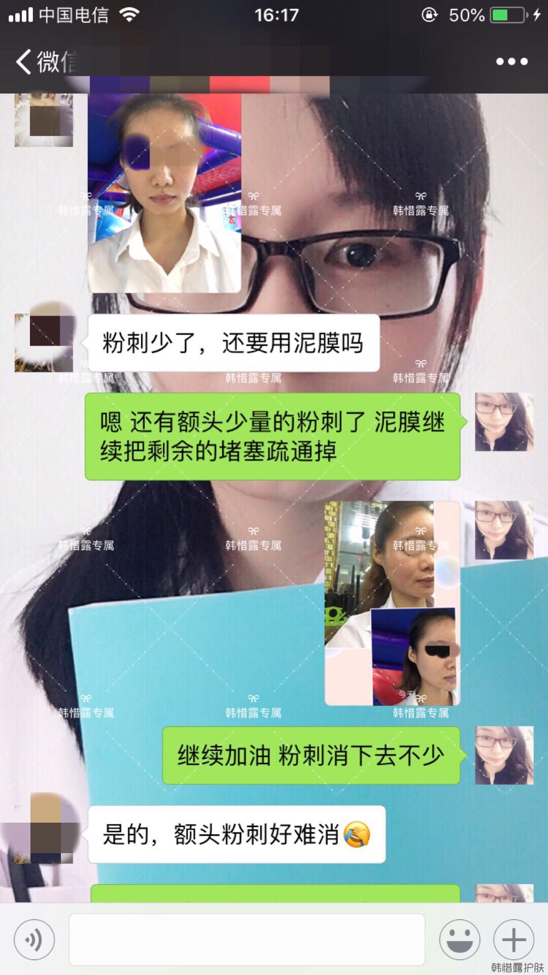 閉口粉刺怎么去除?嚴(yán)格按要求使用，粉刺效果不錯(cuò)！