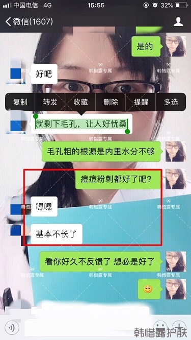 粉刺痘痘，痘印都沒了，寶媽重回顏值巔峰！