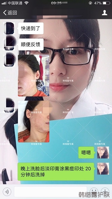 激素臉滿臉粉刺痘痘到光滑健康肌膚的蛻變