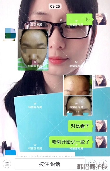 臉上長粉刺怎么辦？額頭長粉刺怎么辦？