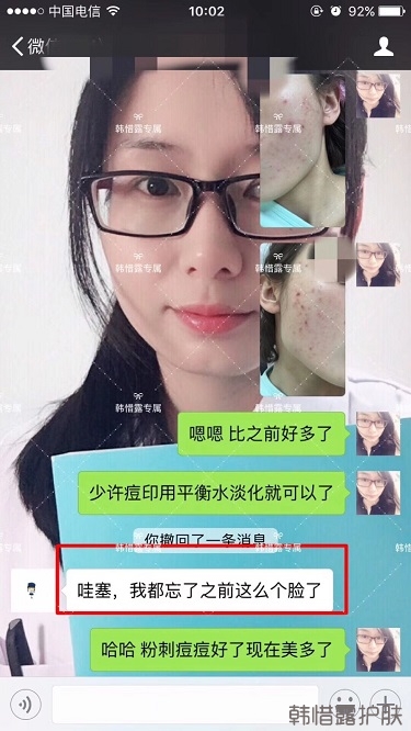 痘痘好了皮膚美麗，不想再記起曾經(jīng)滿臉痘痘的自己！