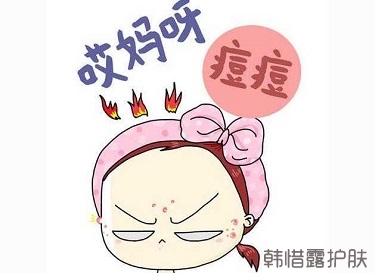 快速祛痘的方法有哪些？