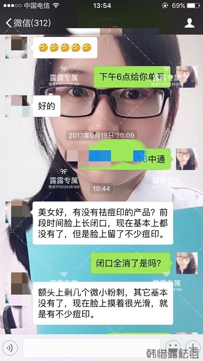 【徹底祛痘方法效果】痘痘基本沒(méi)有了，痘印淡了！