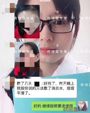 什么產(chǎn)品祛痘效果好？有什么祛痘效果好的產(chǎn)品？