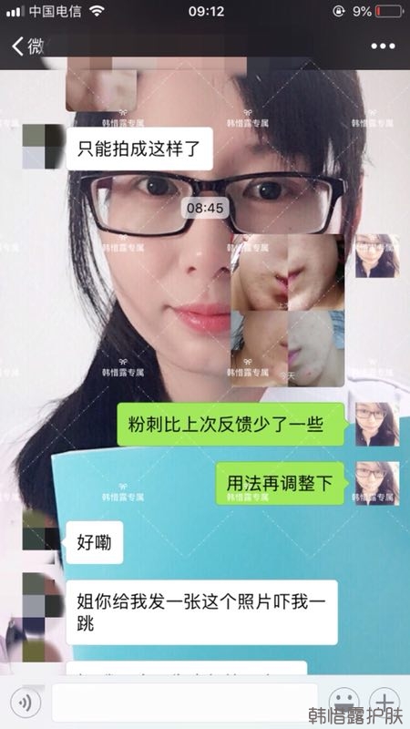 粉刺多怎么辦？按照要求配套耐心使用，粉刺消下去不少！