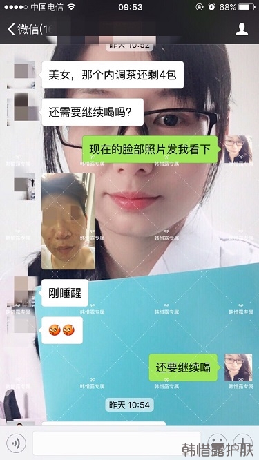 膿包結(jié)節(jié)發(fā)硬痘痘全消了，帥哥開心的來反饋了！