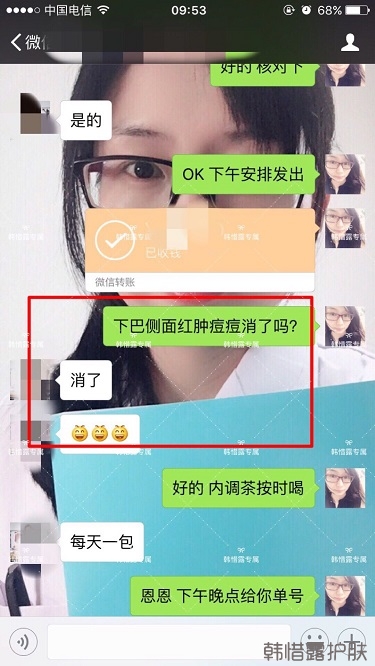 膿包結(jié)節(jié)發(fā)硬痘痘全消了，帥哥開心的來反饋了！