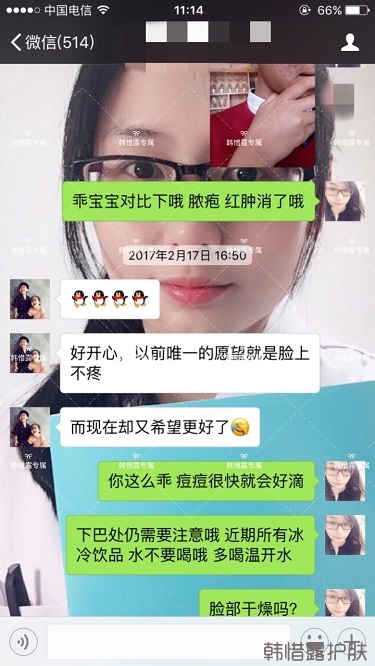 臉上長(zhǎng)痘痘怎么去掉？徹底告別痘痘，自卑到自信的蛻變！