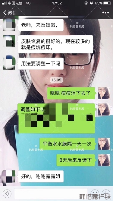 好好使用，膿包痘痘,小粉刺全消了,重點修復(fù)痘印痘坑印了