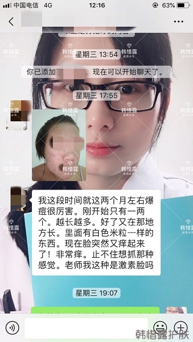 敏感粉刺長(zhǎng)痘皮膚發(fā)炎一招解決！祛痘有辦法