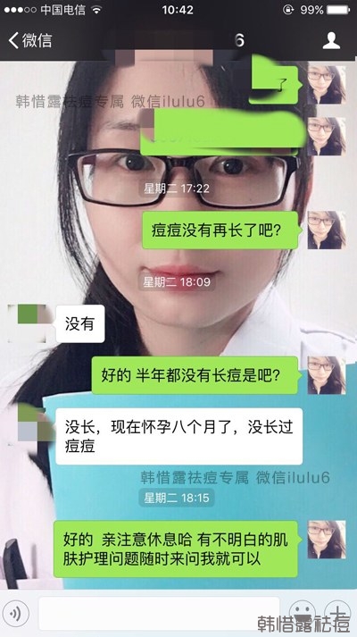 痘痘好了，再也沒有長過，懷孕8個月了！