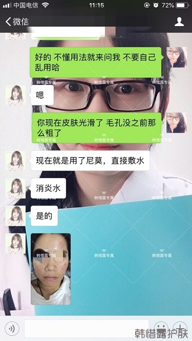 膿包痘祛痘效果，擁有干凈的臉不等待！