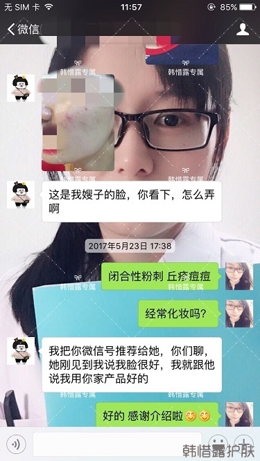 下巴長痘怎么辦？看這里徹底去掉痘痘，不再長痘了！