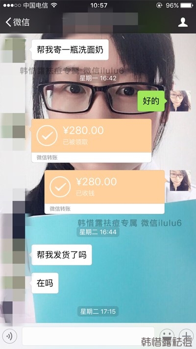 痘痘好了，再也沒有長過，懷孕8個月了！