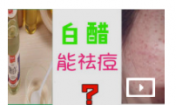白醋可以祛痘嗎？